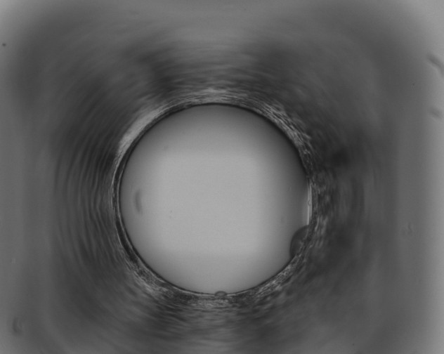 X0000092320147200709141057