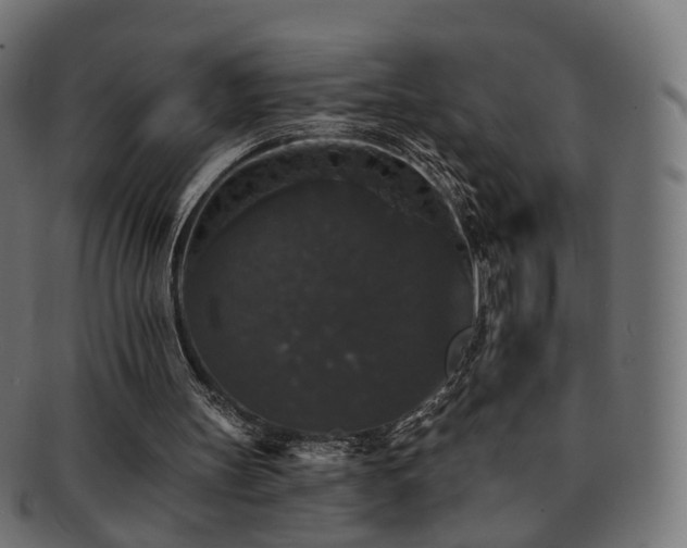 X0000092320147200709141419