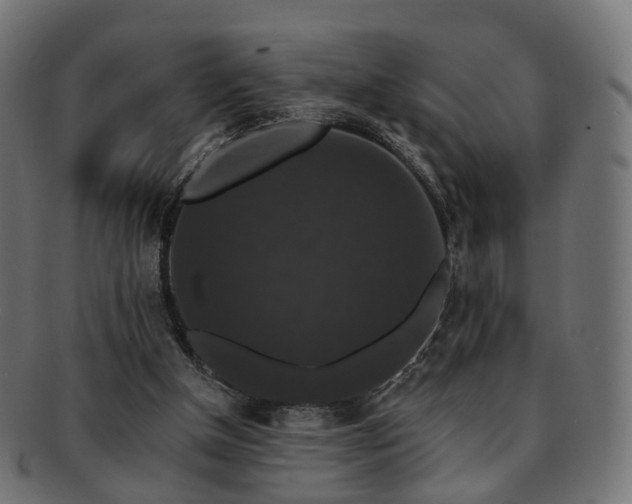 X0000092320154200709141419