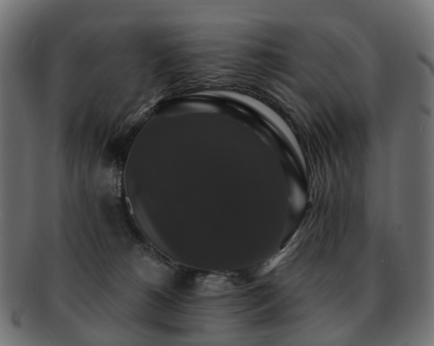 X0000092320180200709141420