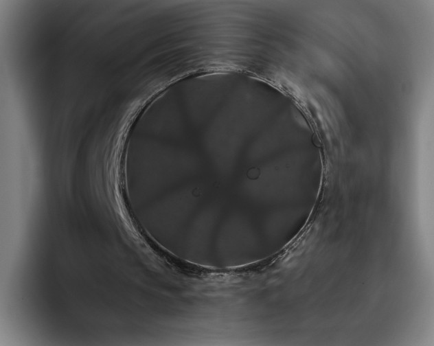 X0000092320145200709211335