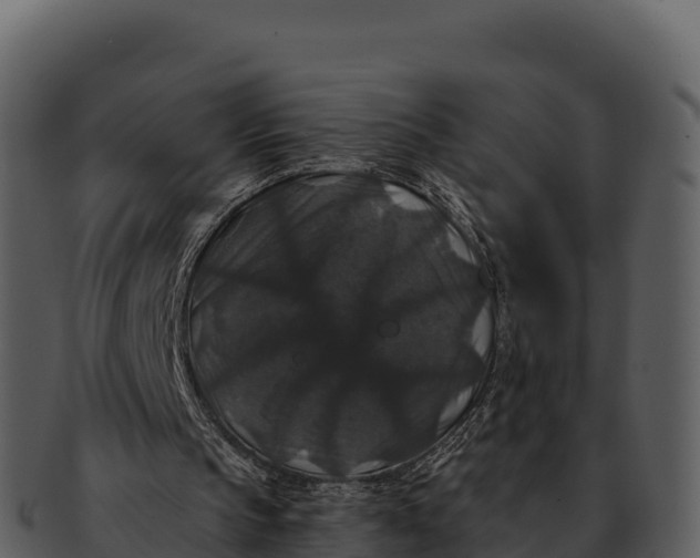 X0000092320145200710051303