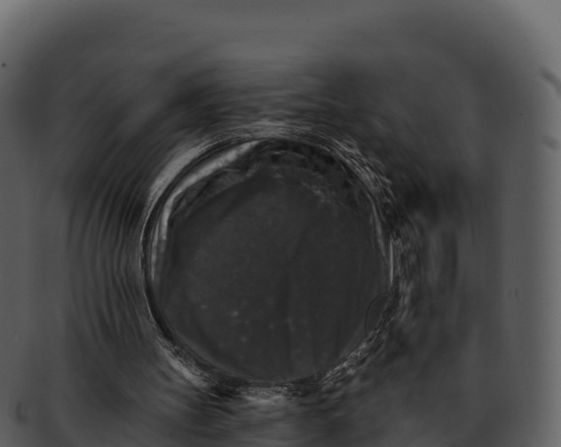X0000092320147200710051303