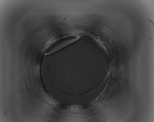 X0000092320154200710051303