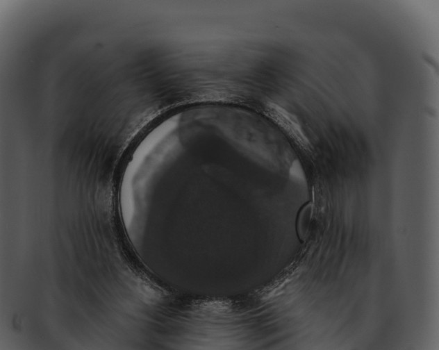 X0000092320156200710051303