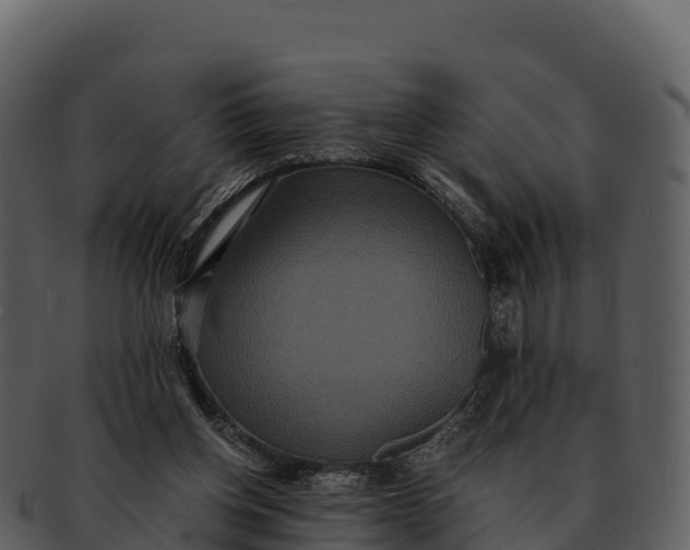 X0000092320158200710051303