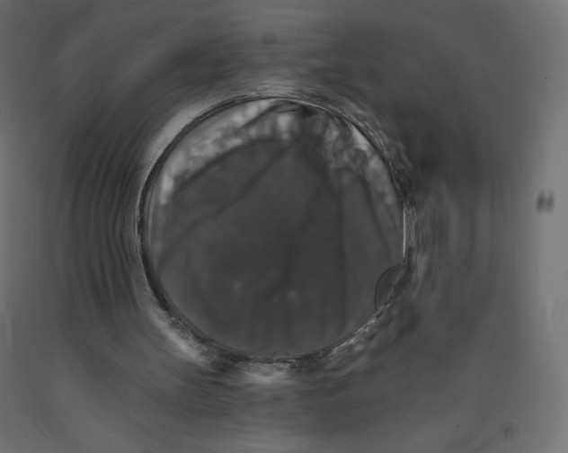 X0000092320147200710121529
