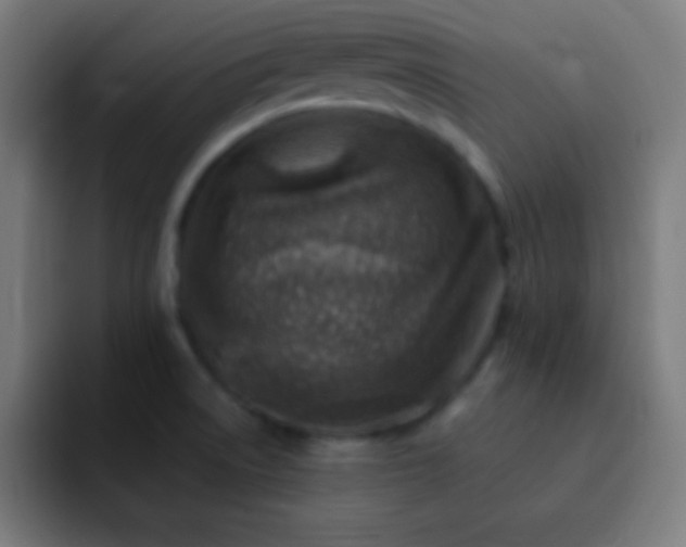 X0000093101522200710031820