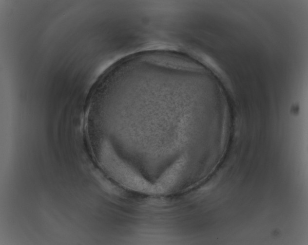 X0000093101220200710101531