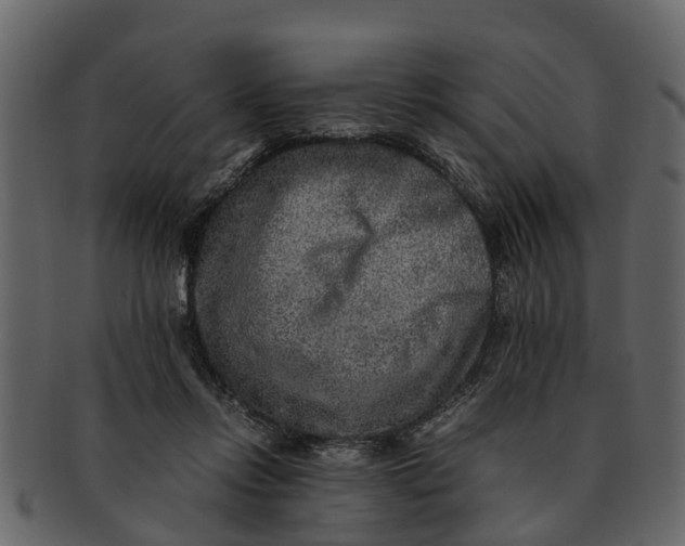 X0000093100358200710171206