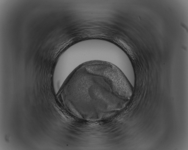 X0000093100405200710171205