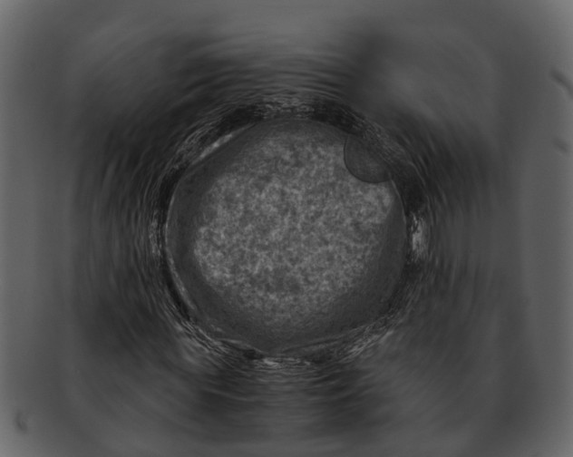 X0000093100819200710171158
