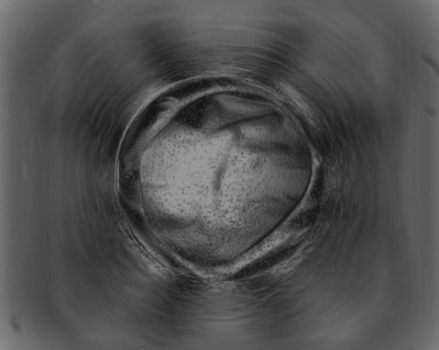 X0000093100940200710171157