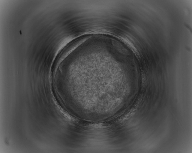 X0000093100990200710171156