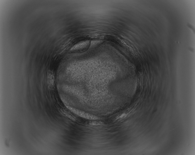 X0000093101154200710171154
