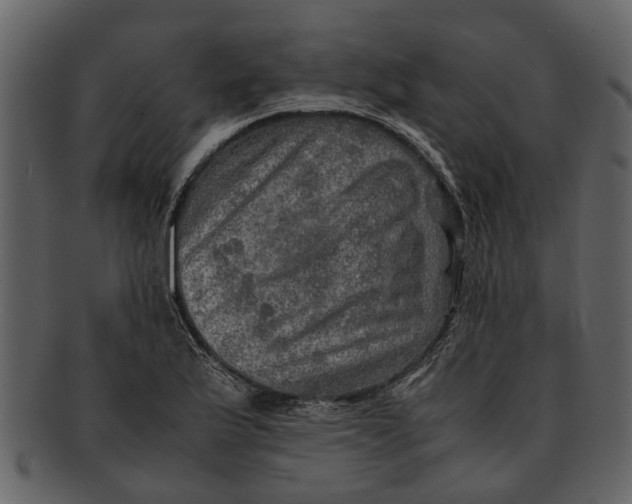 X0000093101175200710171154