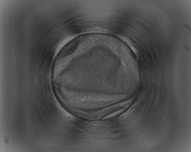 X0000093101387200710171151