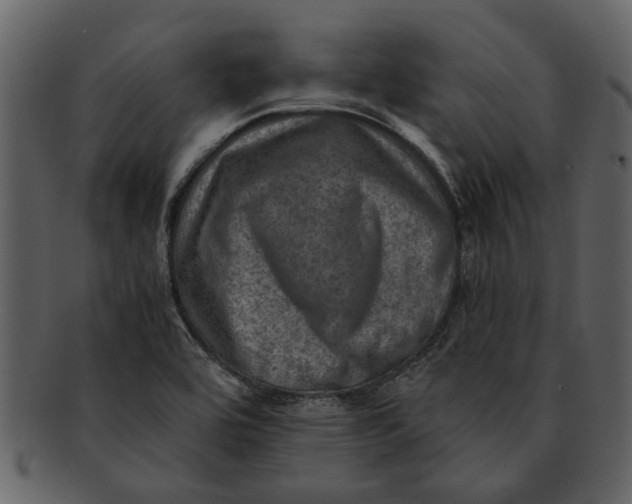 X0000093101464200710171150