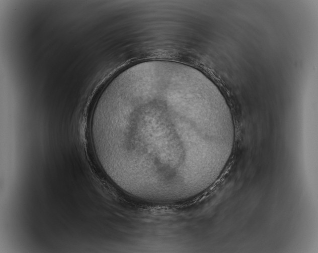 X0000093110146200710101028