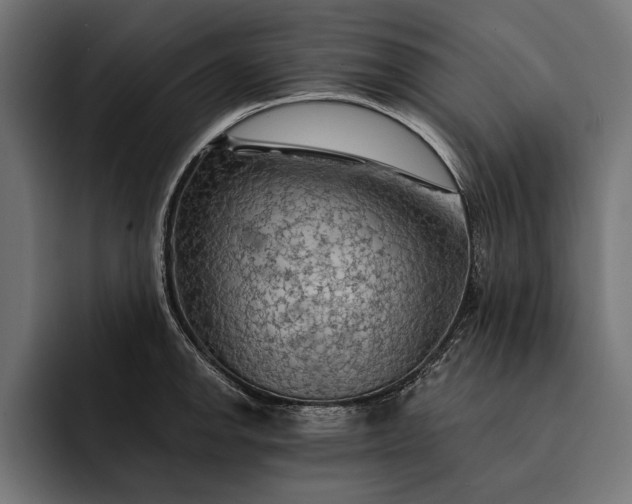 X0000093111142200710101017