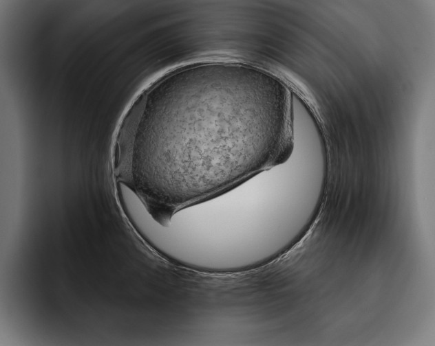 X0000093111192200710101016