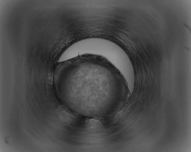 X0000093110180200710171230