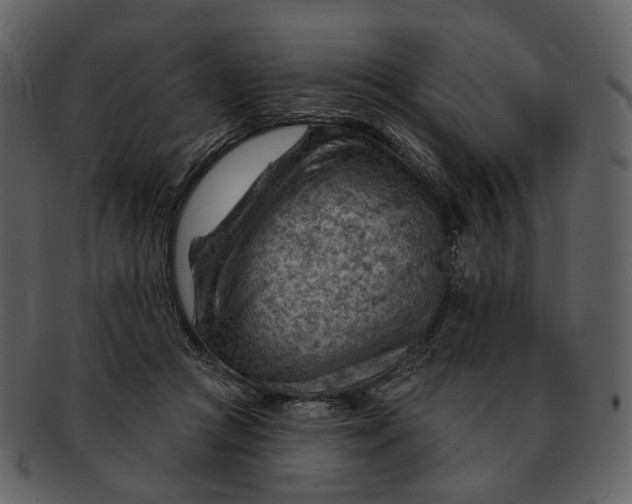 X0000093110361200710171228