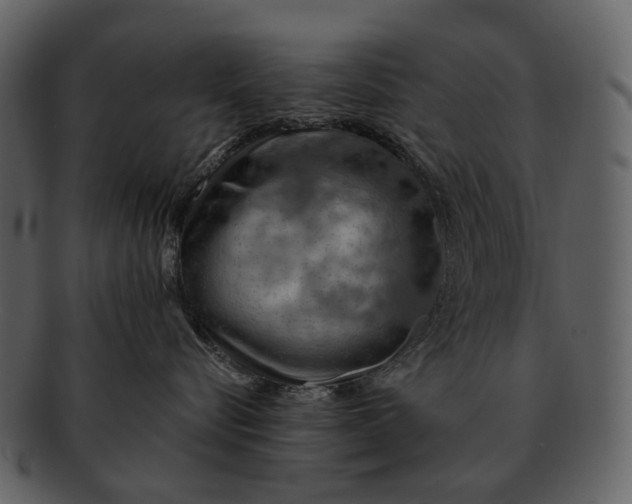 X0000093110576200710171225