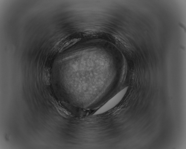 X0000093110868200710171220