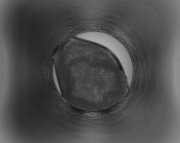 X0000093120417200710031337