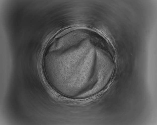 X0000093120001200710101049