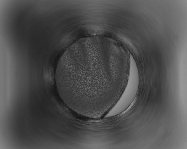 X0000093120170200710101047