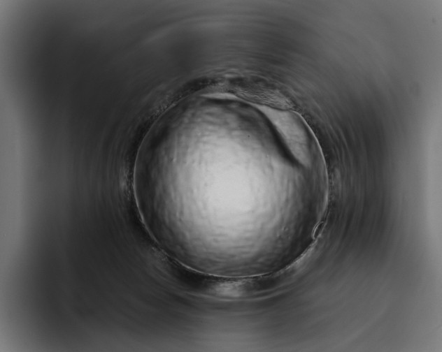 X0000093120178200710101047