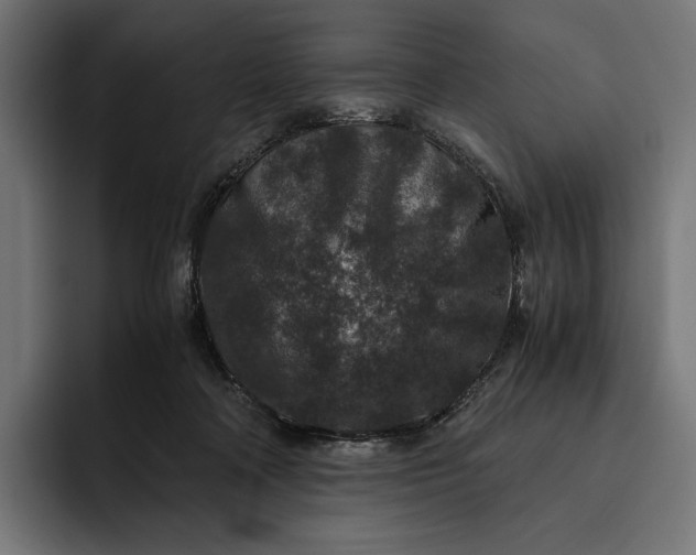 X0000093120314200710101045