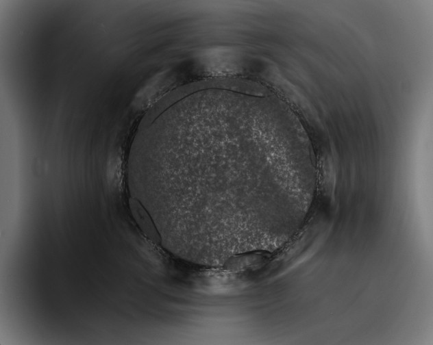 X0000093120762200710101040