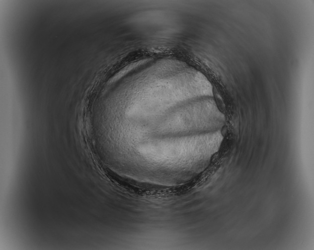 X0000093120817200710101038