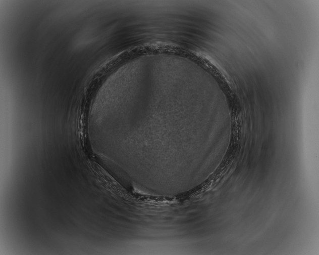 X0000093120919200710101037