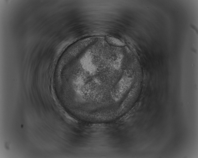 X0000093120145200710171253