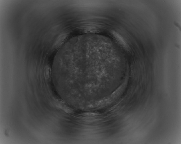 X0000093120169200710171253