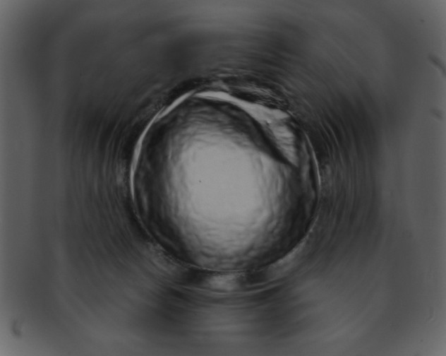 X0000093120178200710171253