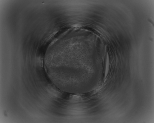 X0000093120180200710171253