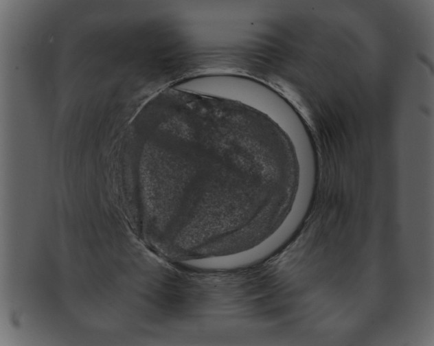 X0000093120385200710171250