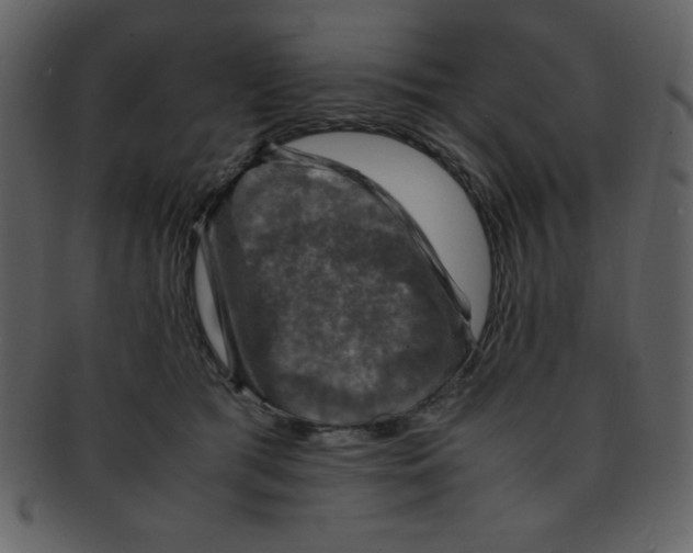 X0000093120417200710171250