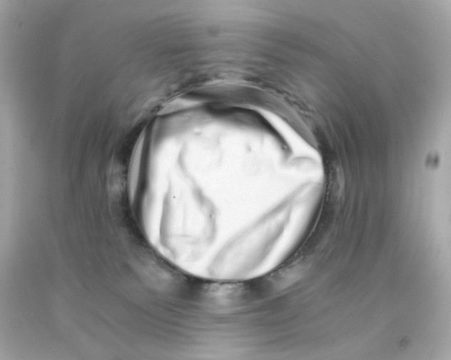 X0000093120135200710241310