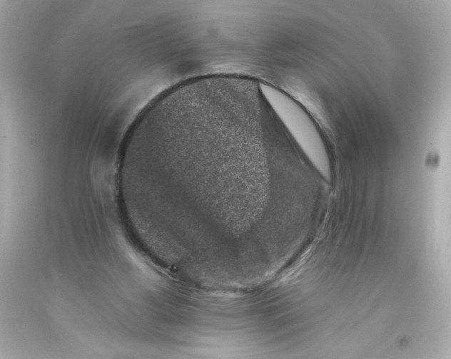 X0000093120156200710241310