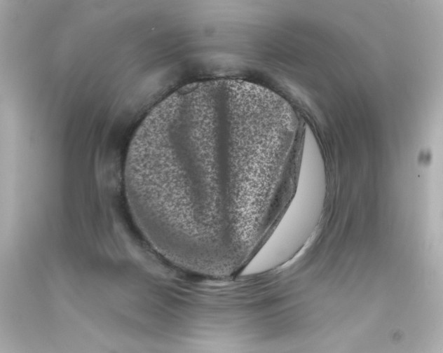 X0000093120170200710241310