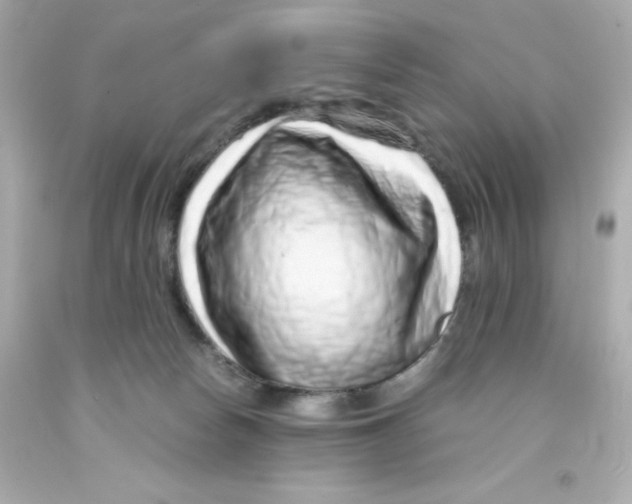 X0000093120178200710241310