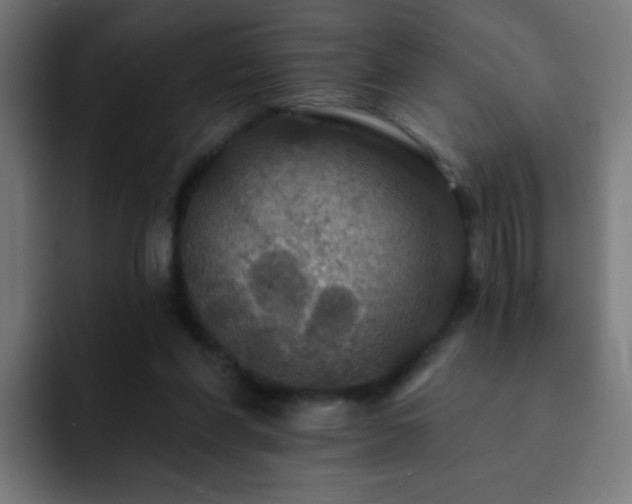 X0000093130206200710031358