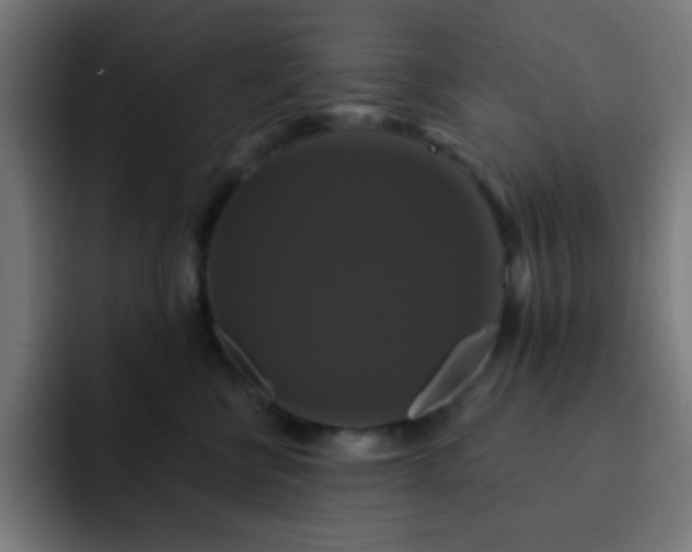 X0000093130570200710031354