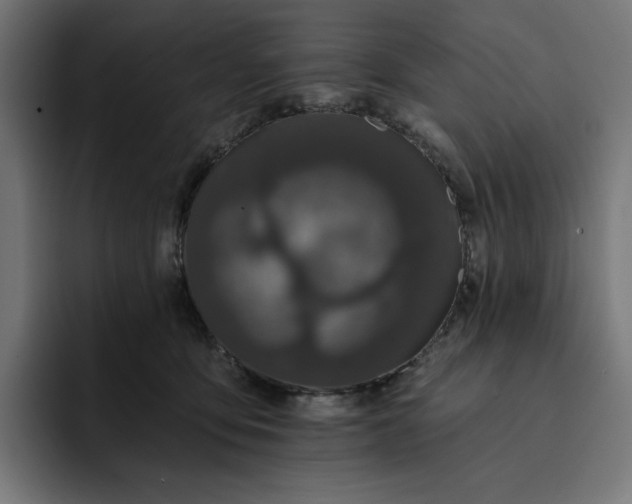 X0000093130419200710101102